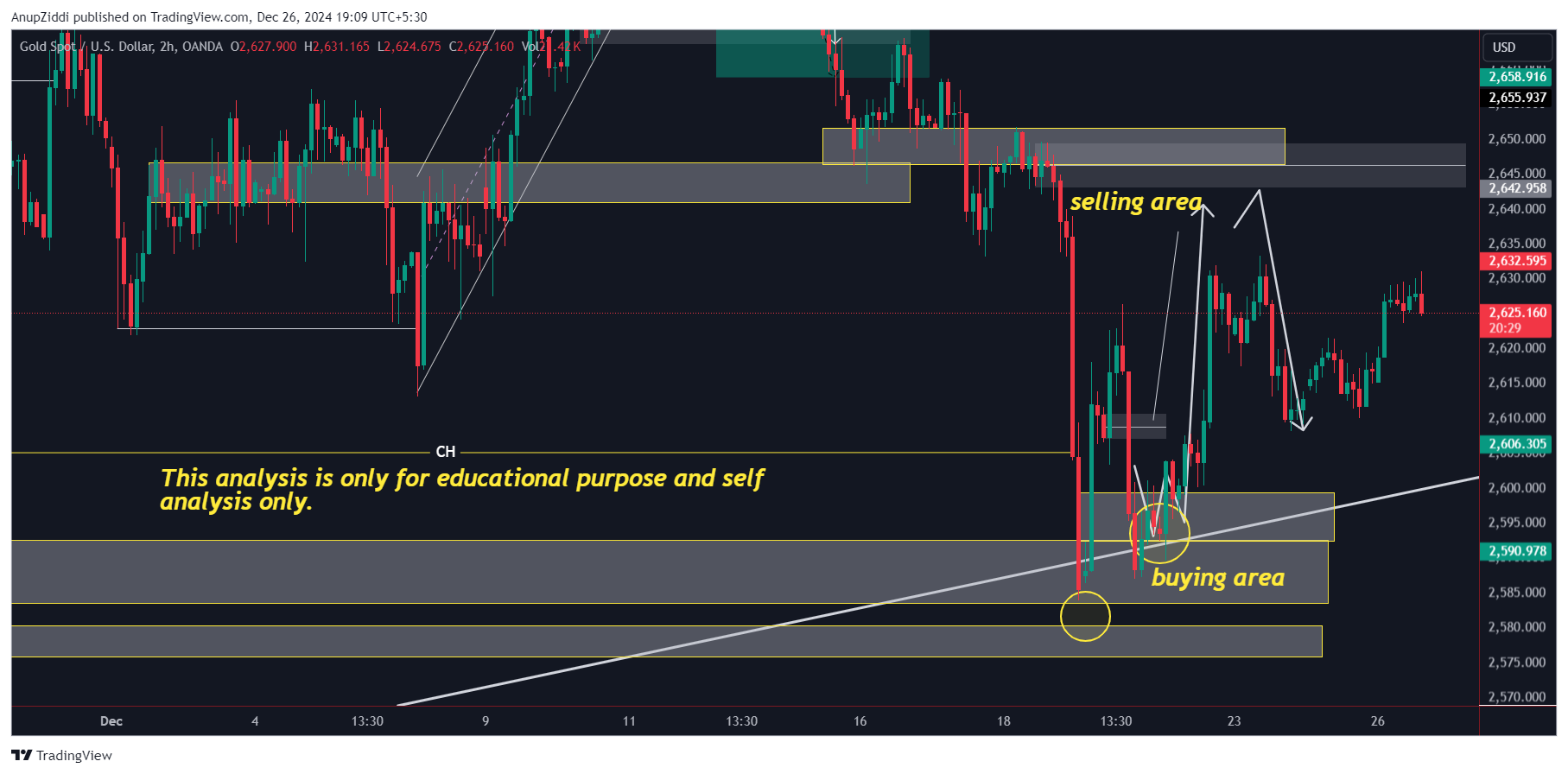 OANDA:XAUUSD Chart Image by AnupZiddi