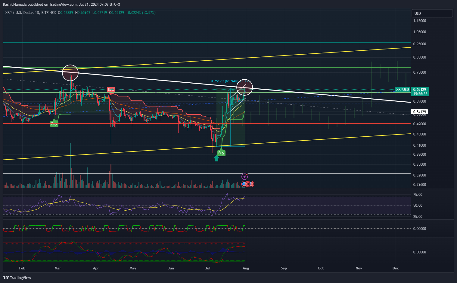 BITFINEX:XRPUSD Chart Image by RashidHamada