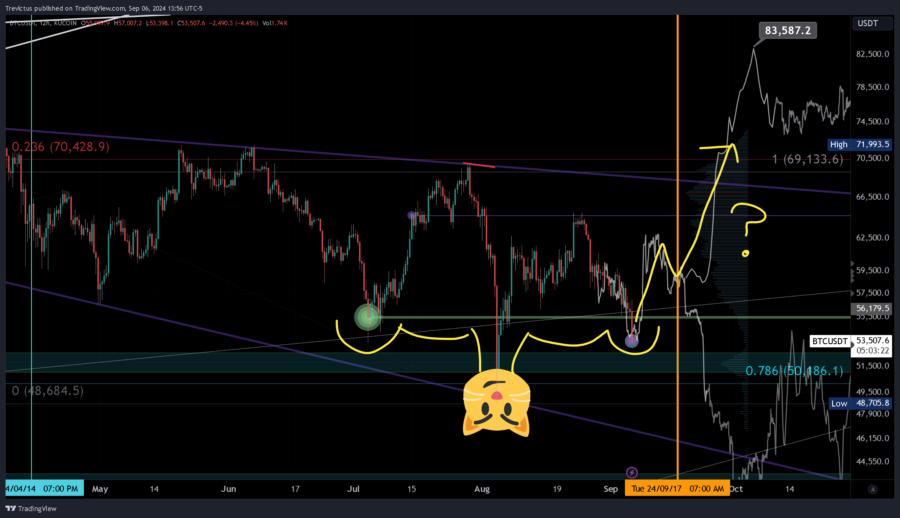 KUCOIN:BTCUSDT Chart Image by Trevictus