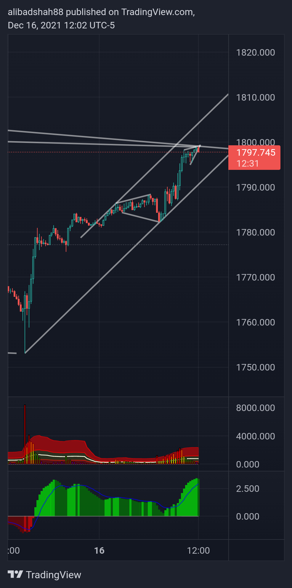 OANDA:XAUUSD Chart Image by alibadshah88