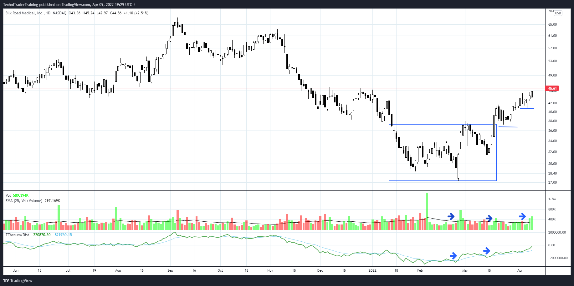 NASDAQ:SILK Chart Image by MarthaStokesCMT-TechniTrader