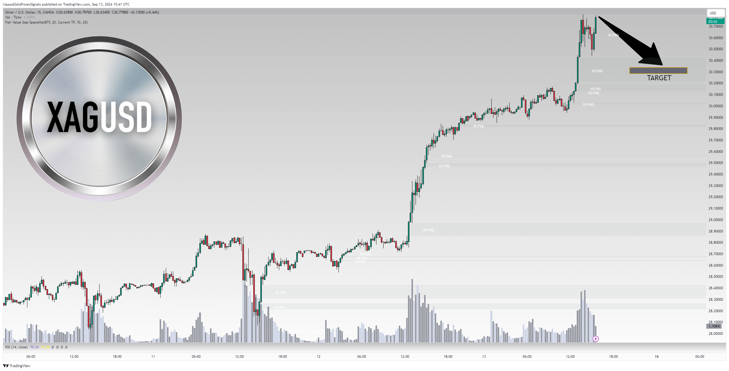 OANDA:XAGUSD Chart Image by XauusdGoldForexSignals