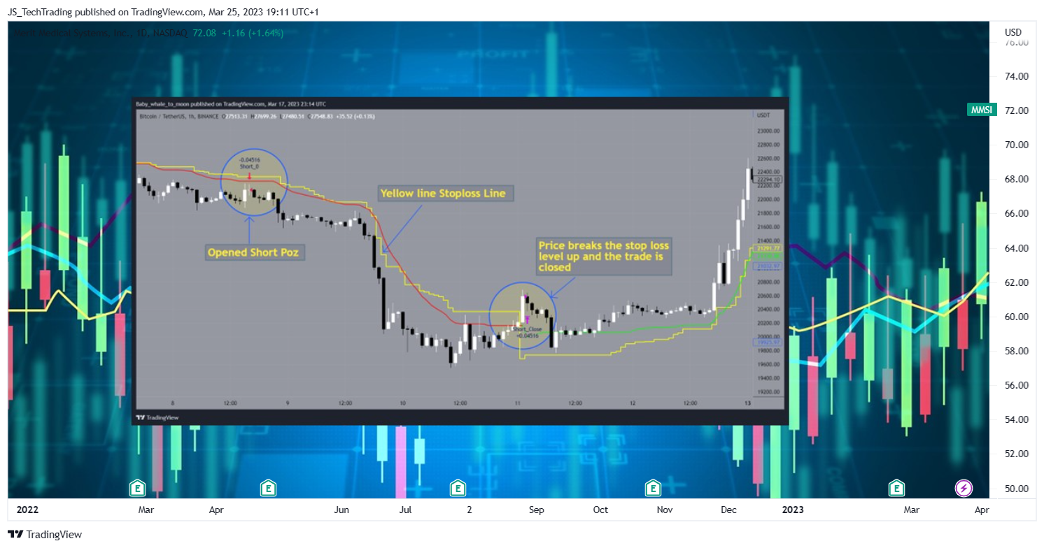 NASDAQ:MMSI Chart Image by JS_TechTrading