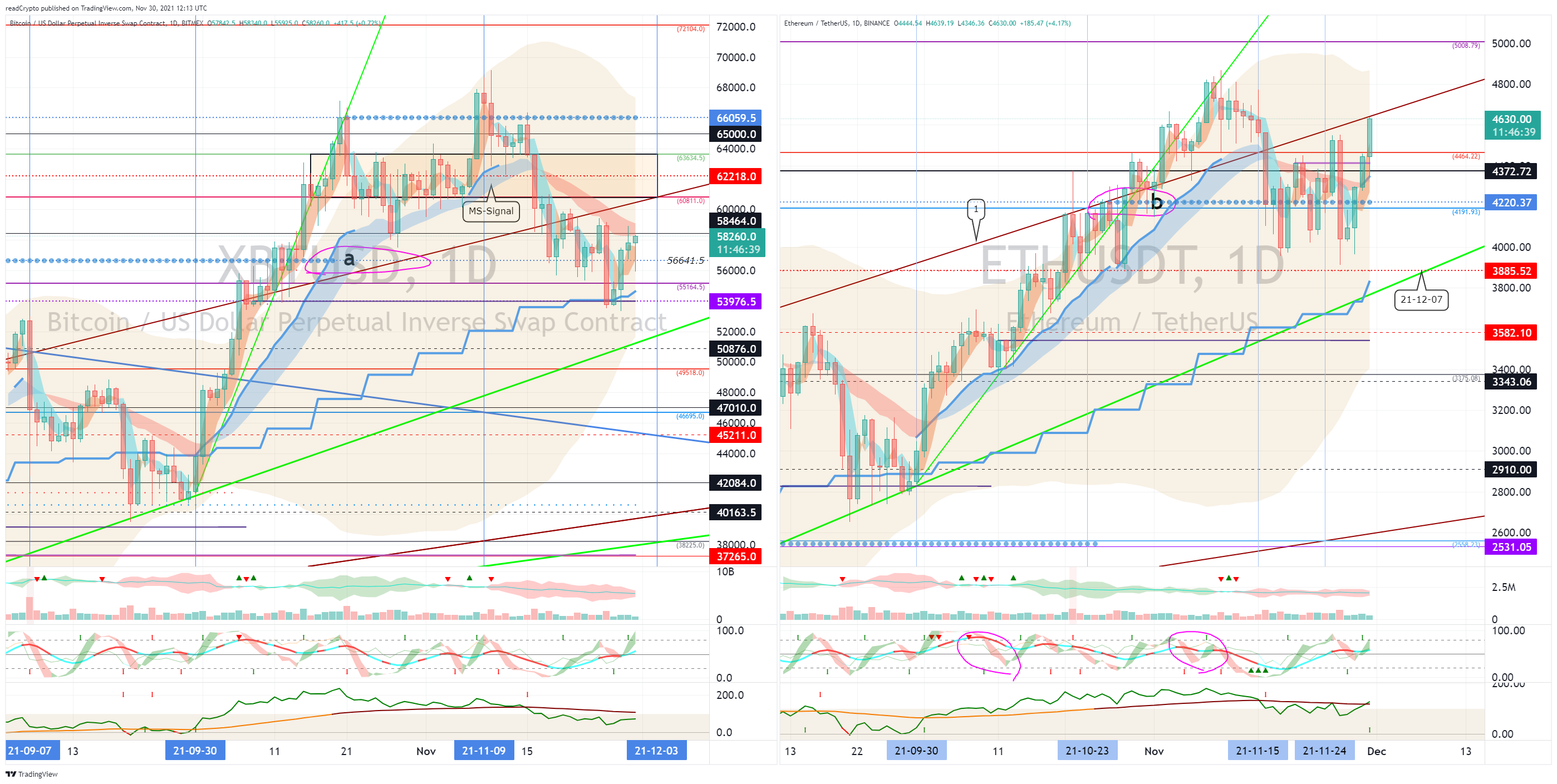 BITMEX:XBTUSD Chart Image by readCrypto