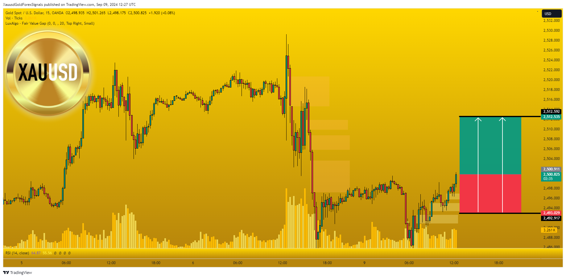 OANDA:XAUUSD Chart Image by XauusdGoldForexSignals