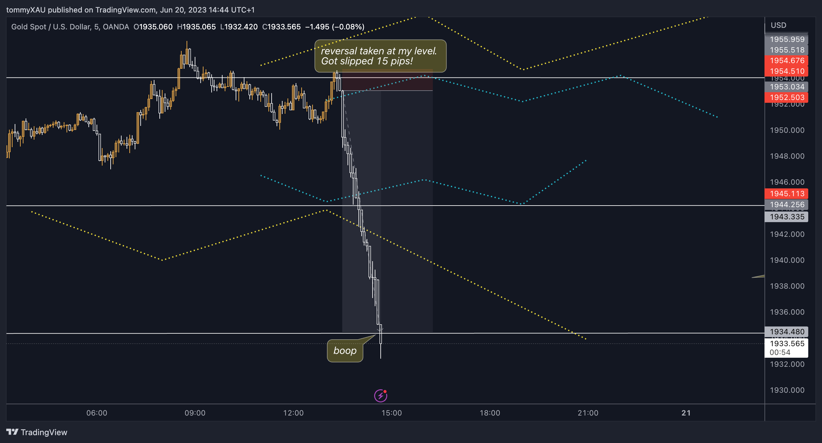 OANDA:XAUUSD Chart Image by tommyXAU