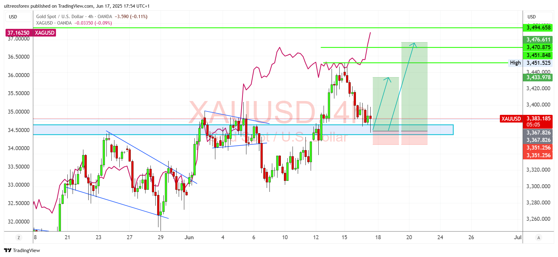 OANDA:XAUUSD Chart Image by ultreosforex