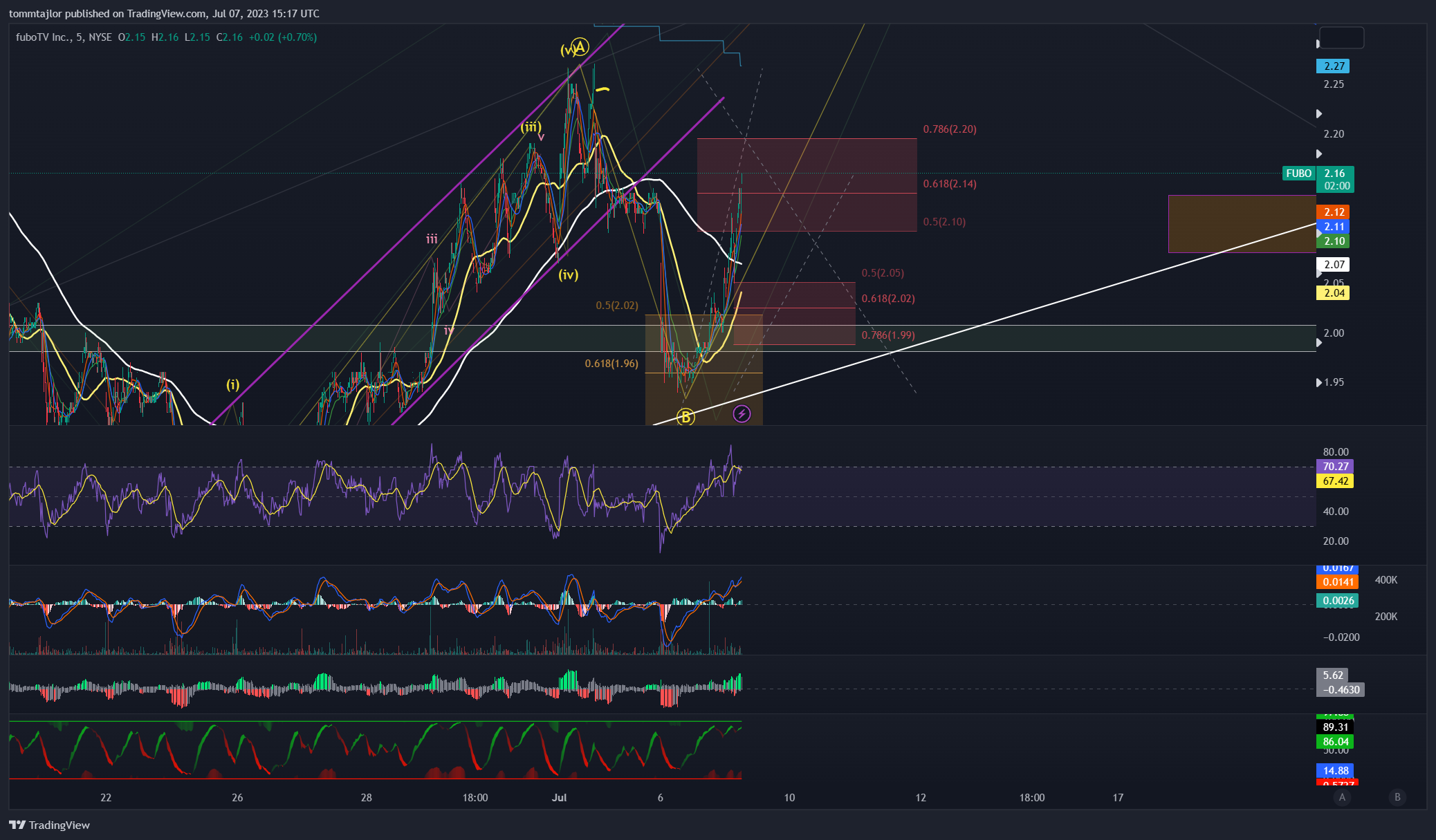 NYSE:FUBO Chart Image by tommtajlor