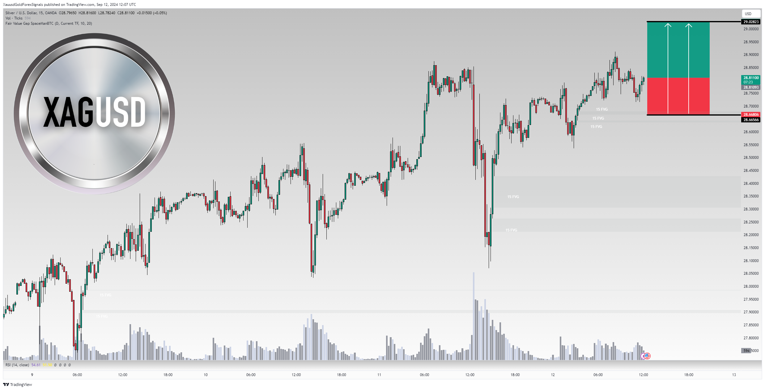 OANDA:XAGUSD Chart Image by XauusdGoldForexSignals