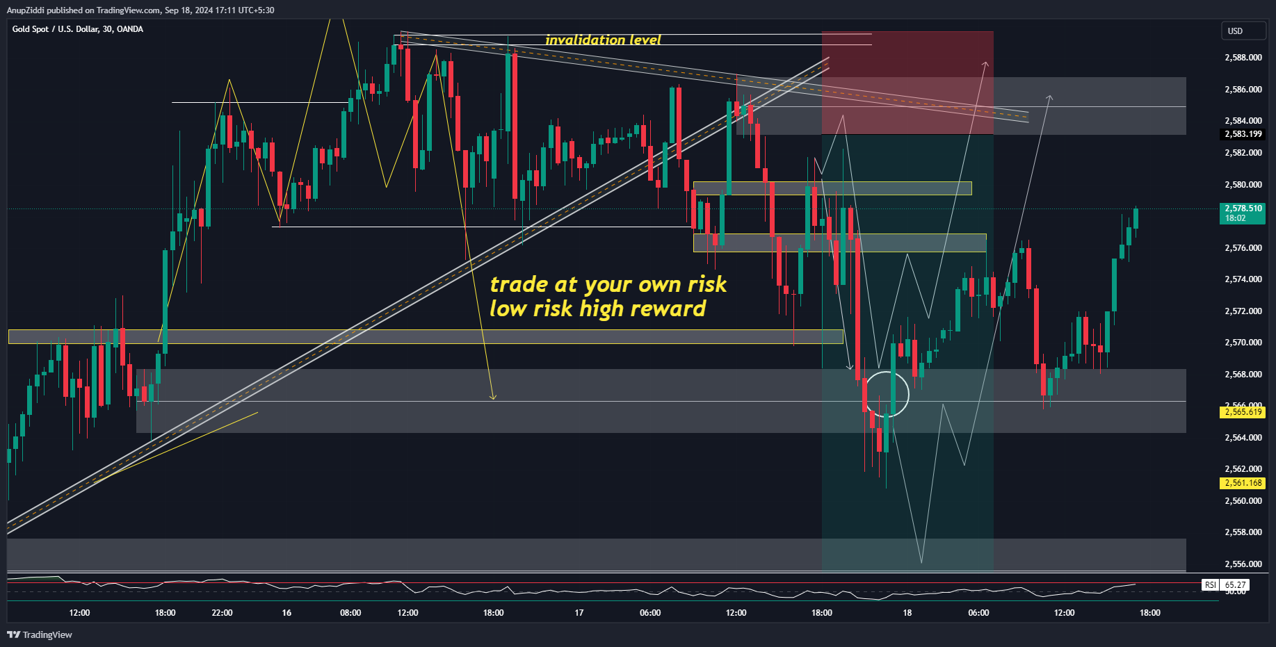 OANDA:XAUUSD Chart Image by AnupZiddi