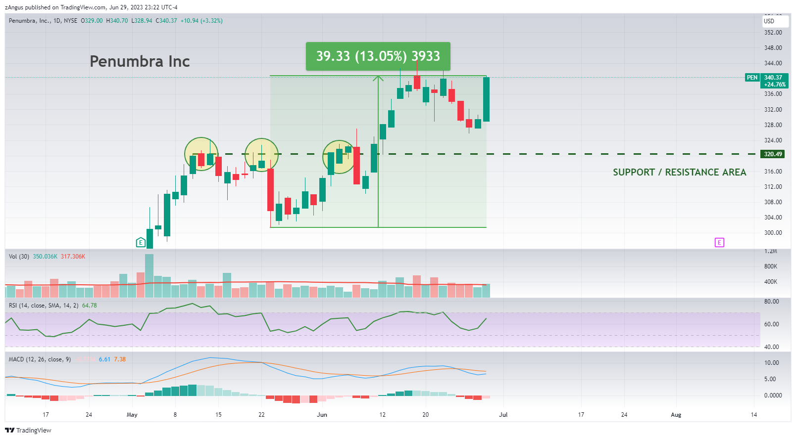 NYSE:PEN Chart Image by zAngus