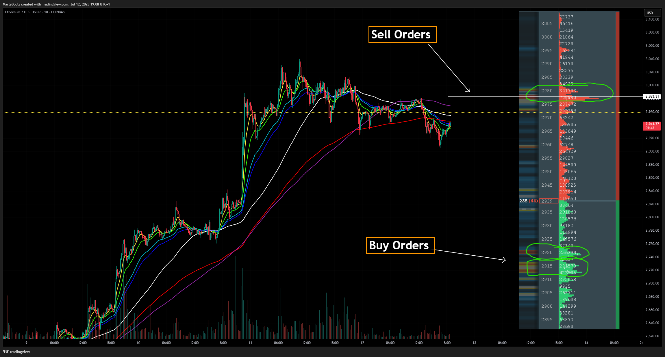 COINBASE:ETHUSD Chart Image by MartyBoots