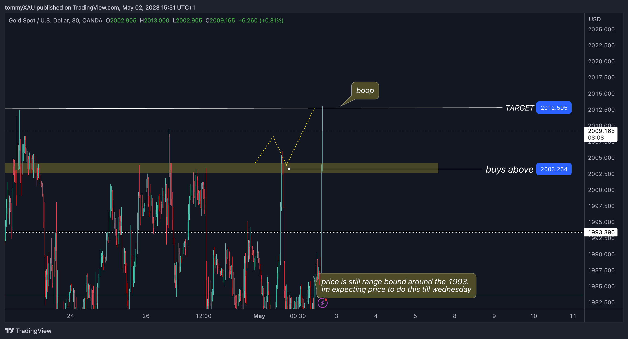 OANDA:XAUUSD Chart Image by tommyXAU