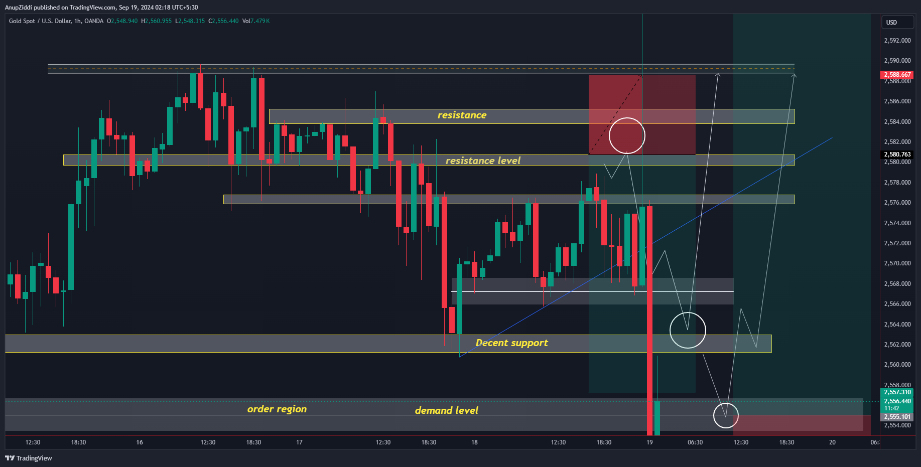 OANDA:XAUUSD Chart Image by AnupZiddi