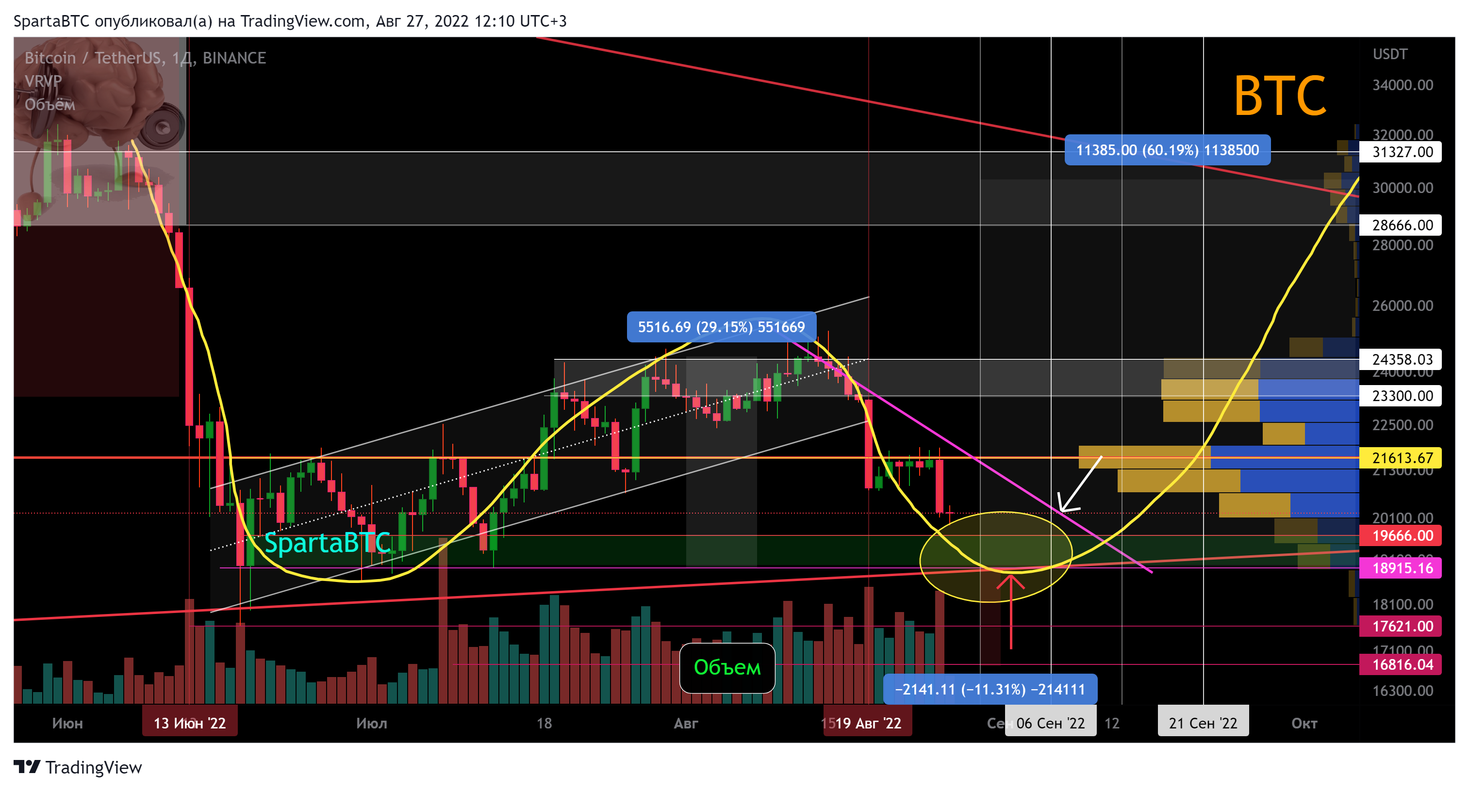 BINANCE:BTCUSDT Chart Image by SpartaBTC