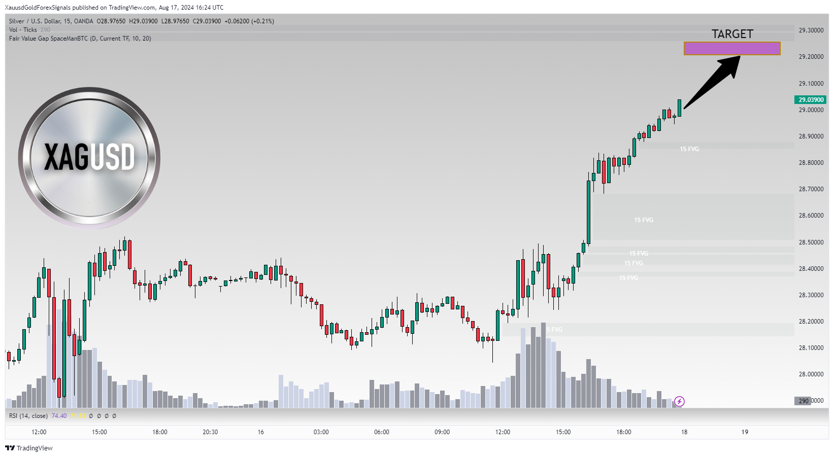 OANDA:XAGUSD Chart Image by XauusdGoldForexSignals