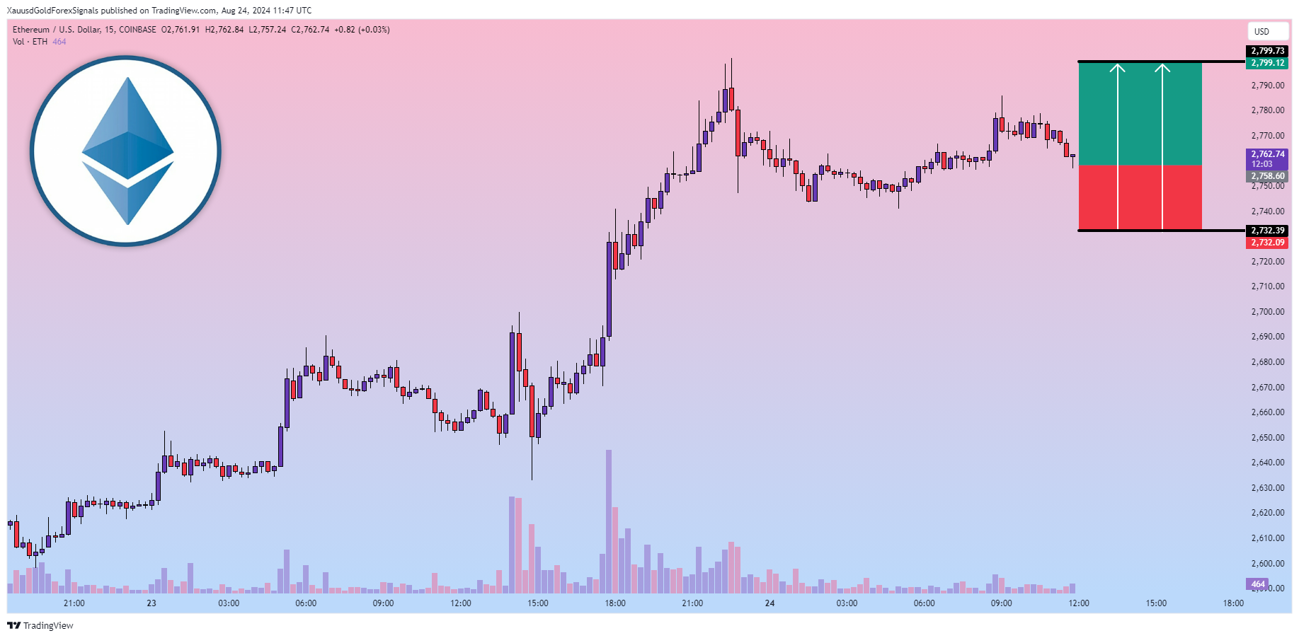 COINBASE:ETHUSD Chart Image by XauusdGoldForexSignals