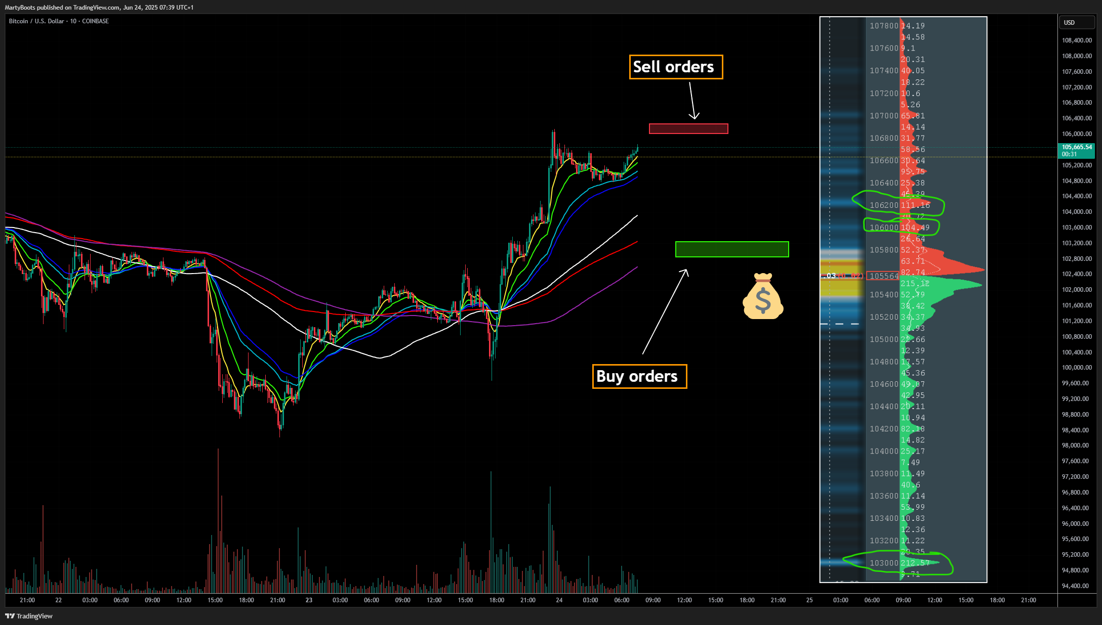 COINBASE:BTCUSD Chart Image by MartyBoots