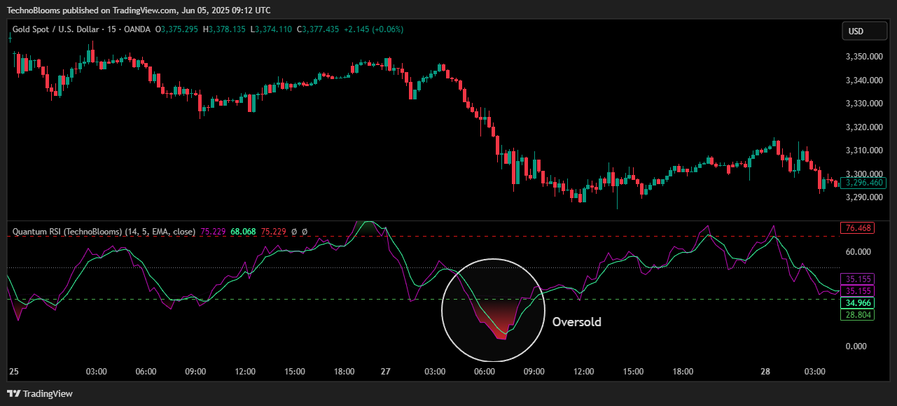 OANDA:XAUUSD Chart Image by TechnoBlooms
