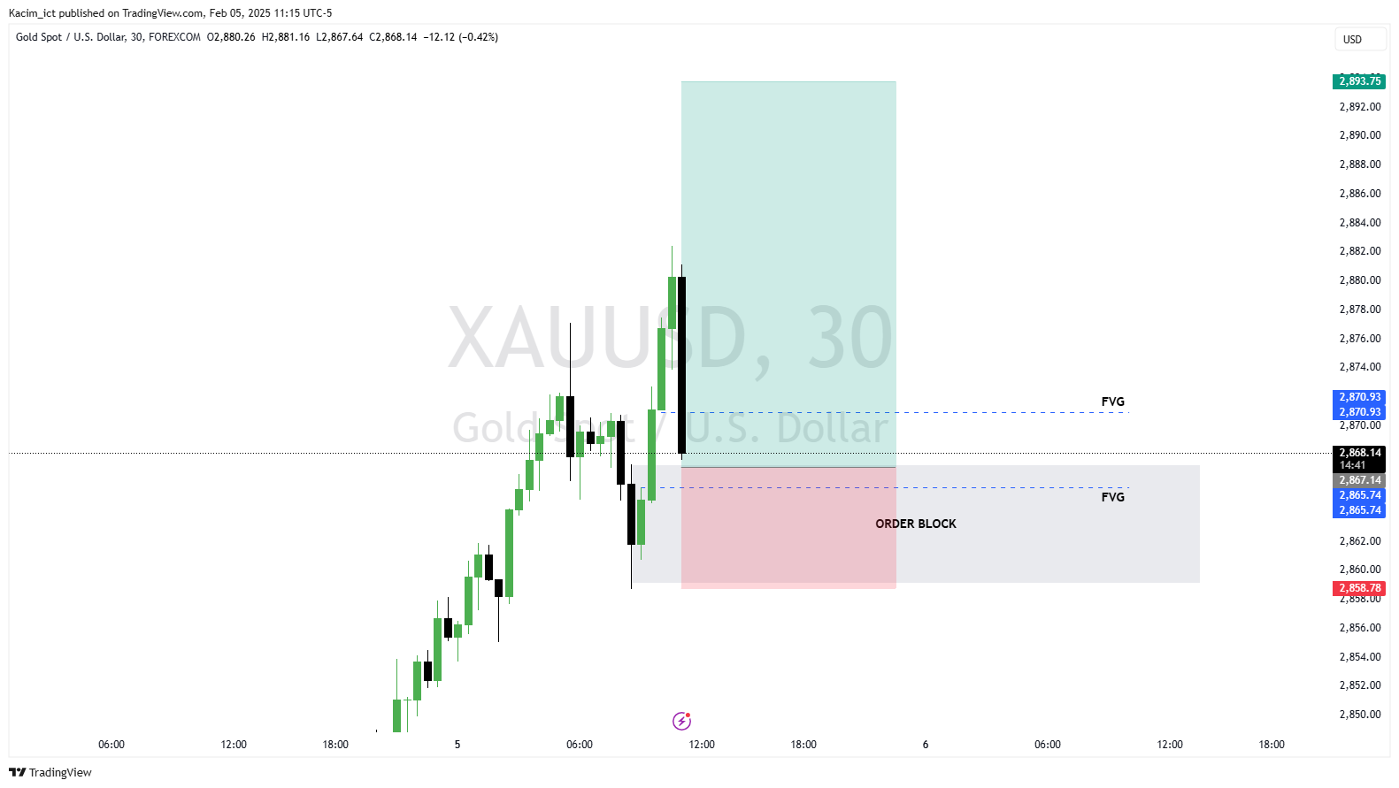 FOREXCOM:XAUUSD Chart Image by Kacim_ict