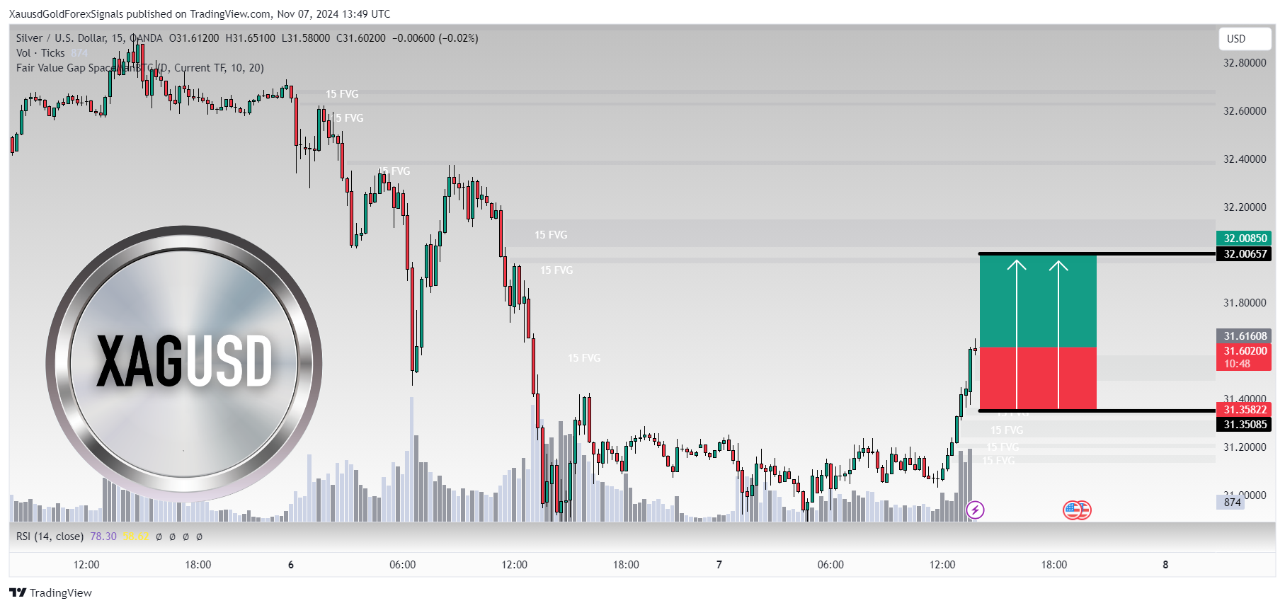 OANDA:XAGUSD Chart Image by XauusdGoldForexSignals