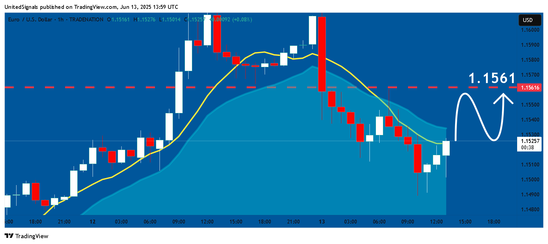 TRADENATION:EURUSD Chart Image by UnitedSignals