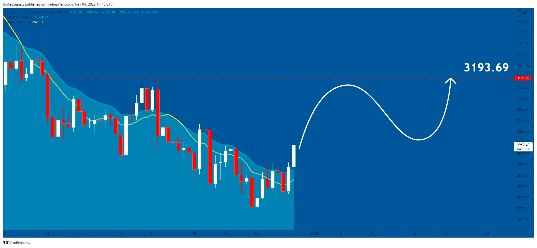 BITFINEX:ETHUSD Chart Image by UnitedSignals