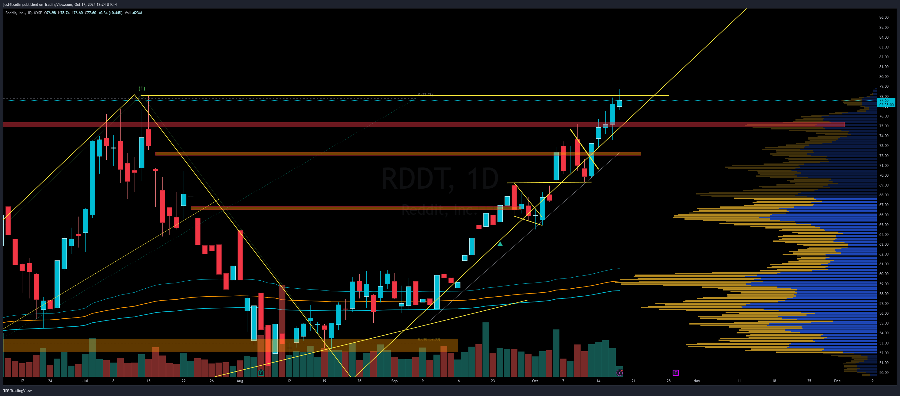 NYSE:RDDT Chart Image by just4tradin