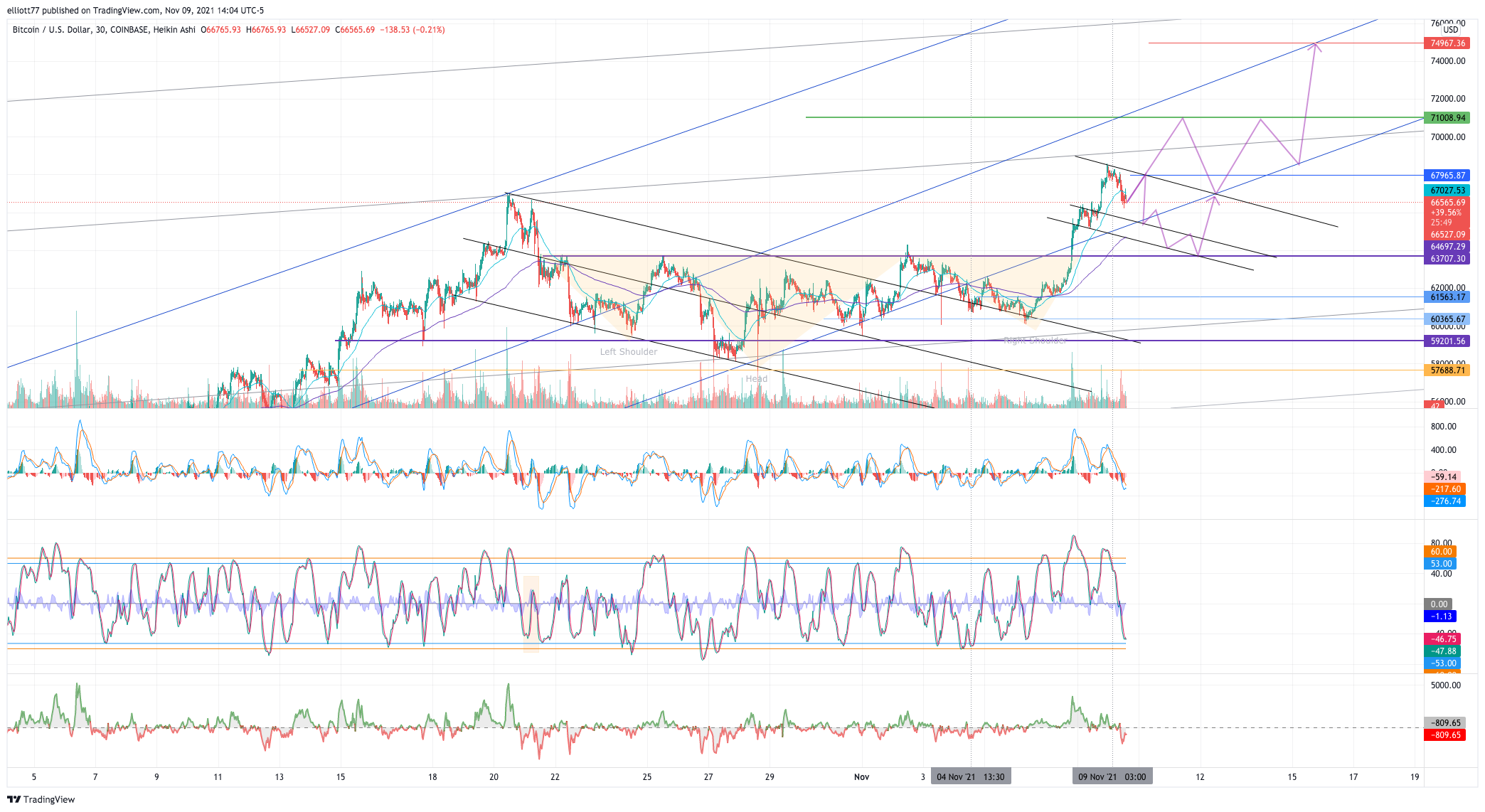 COINBASE:BTCUSD Chart Image by elliott77