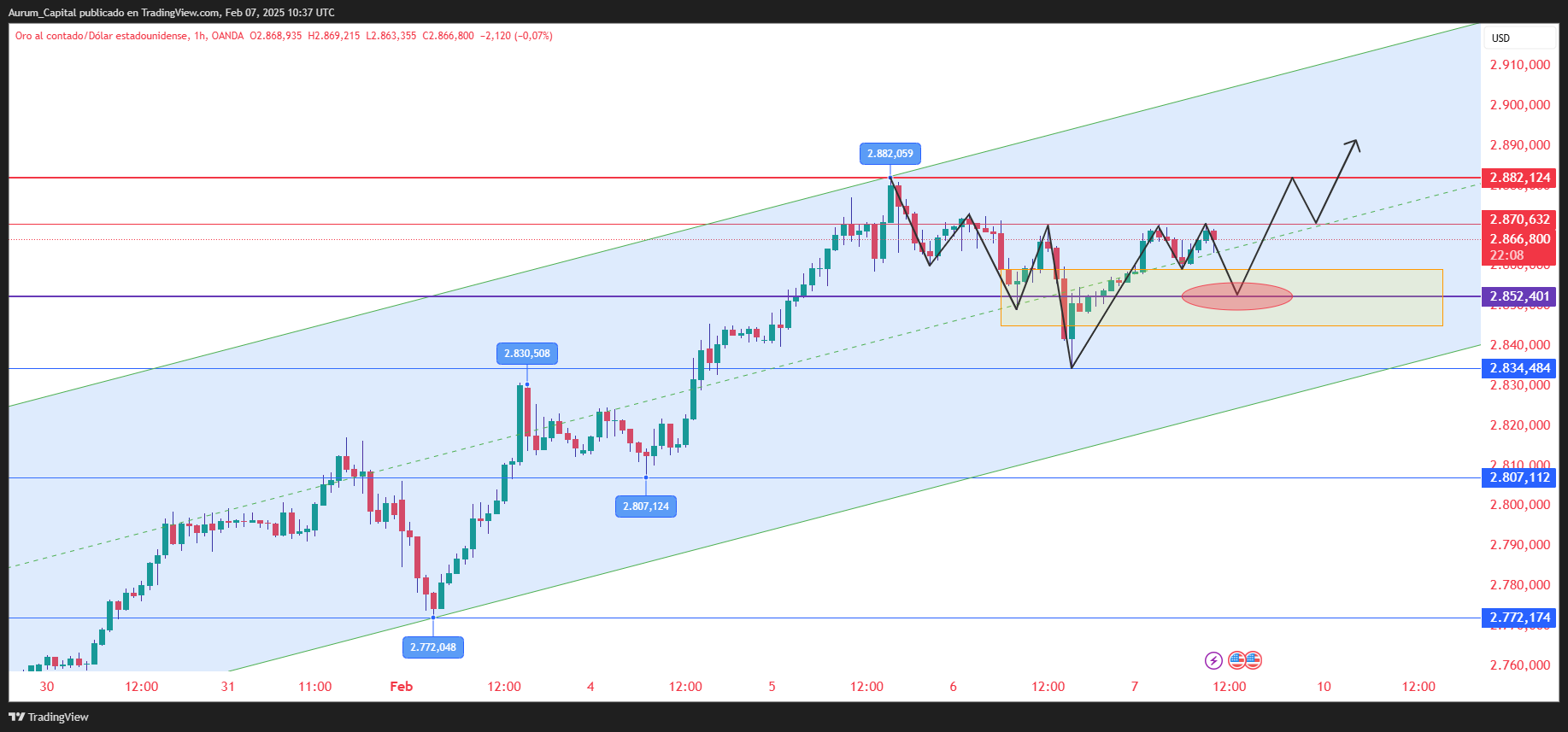 OANDA:XAUUSD Chart Image by Aurum_Capital