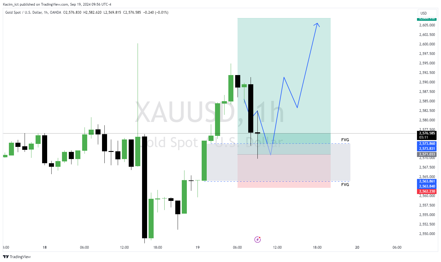 OANDA:XAUUSD Chart Image by Kacim_ict