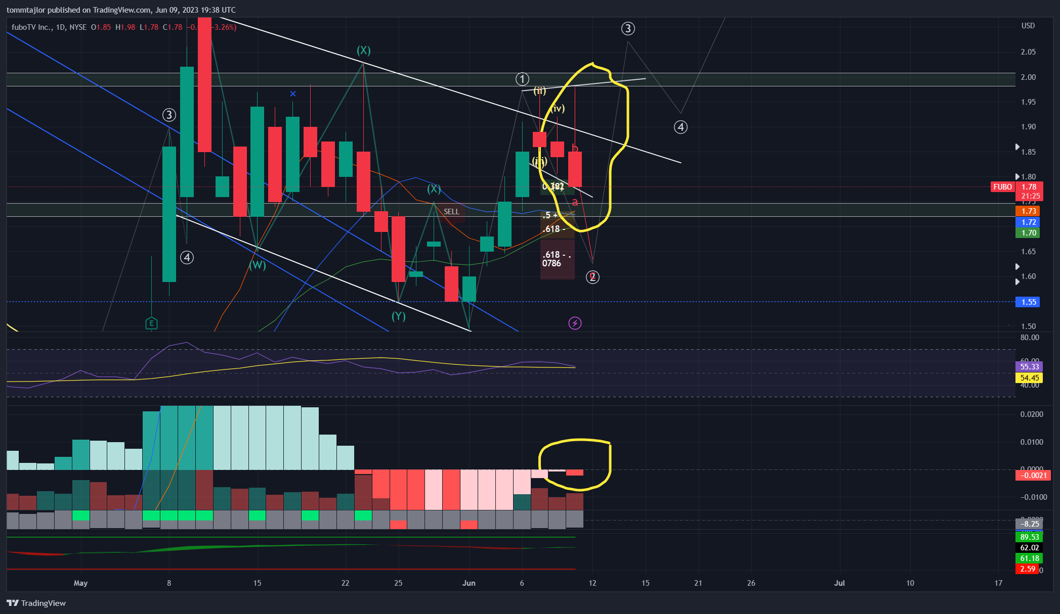 NYSE:FUBO Chart Image by tommtajlor