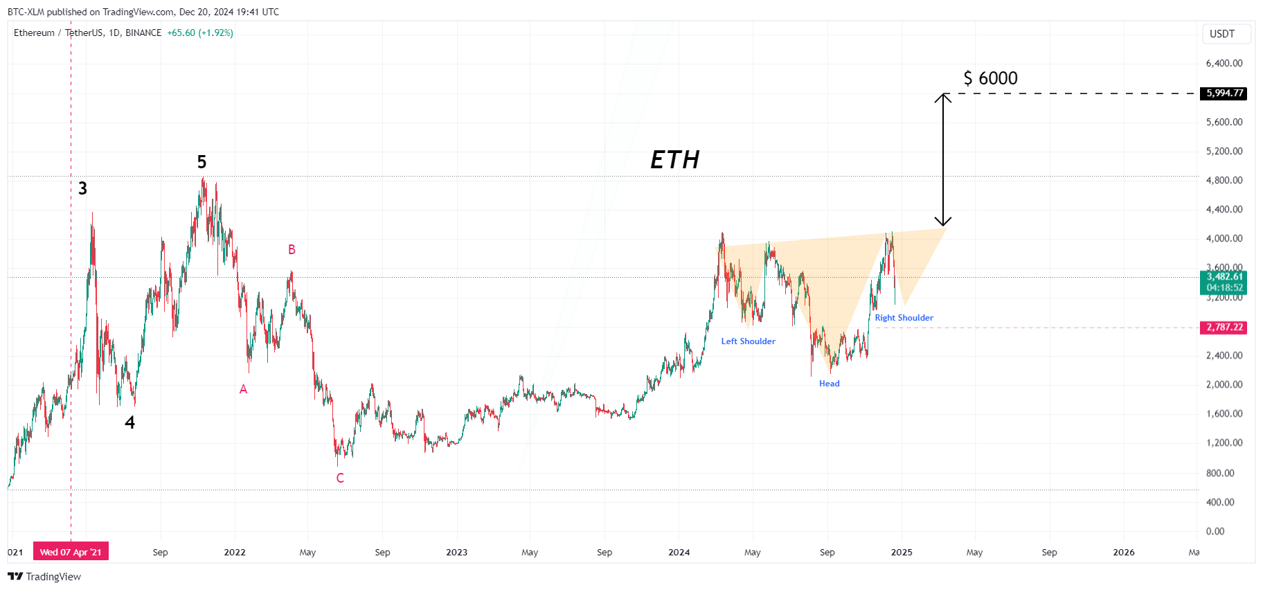 BINANCE:ETHUSDT Chart Image by BTC-XLM