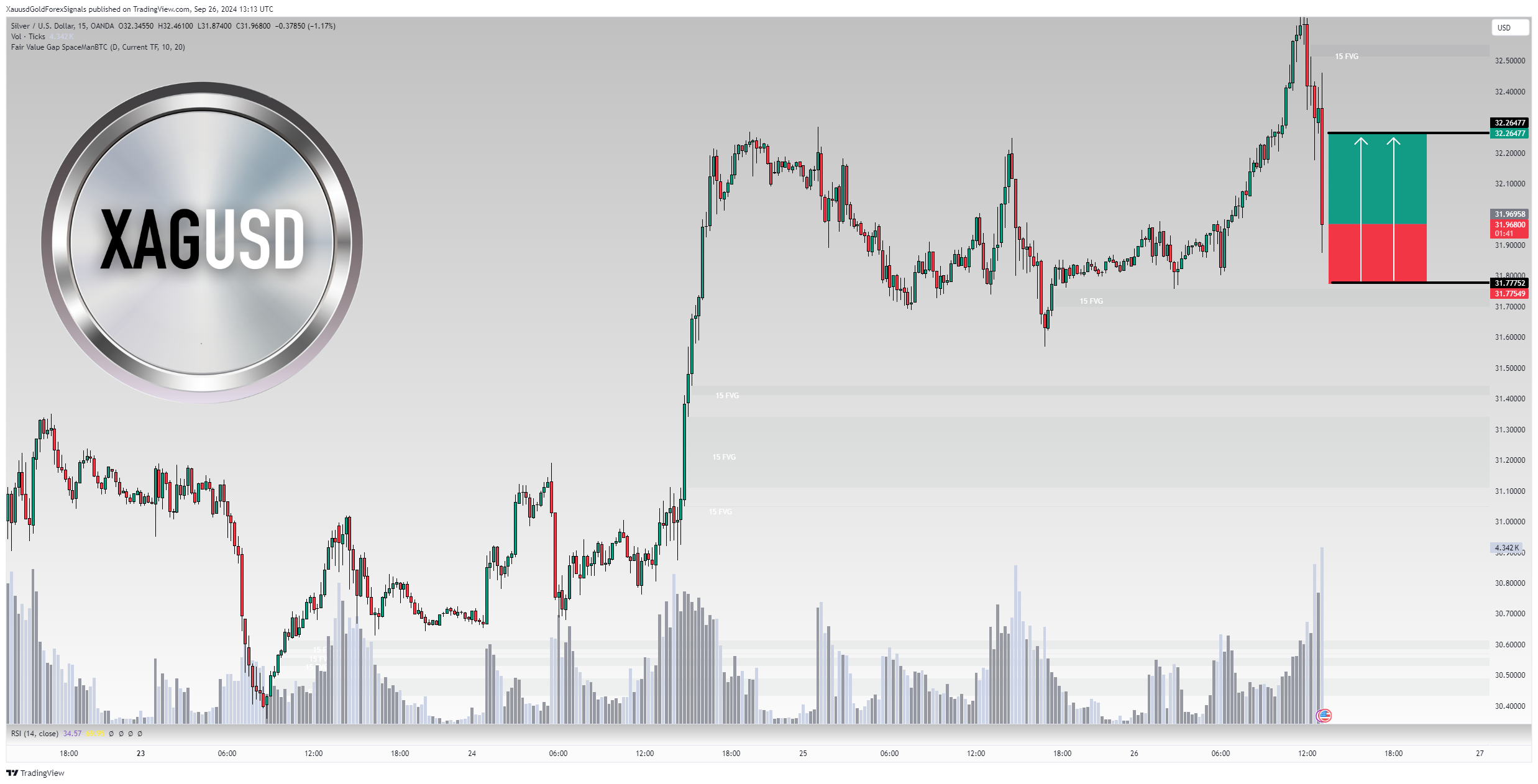 OANDA:XAGUSD Chart Image by XauusdGoldForexSignals