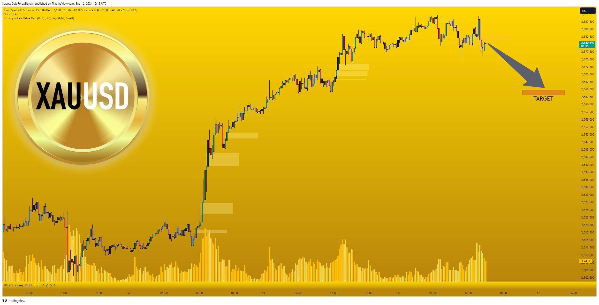 OANDA:XAUUSD Chart Image by XauusdGoldForexSignals