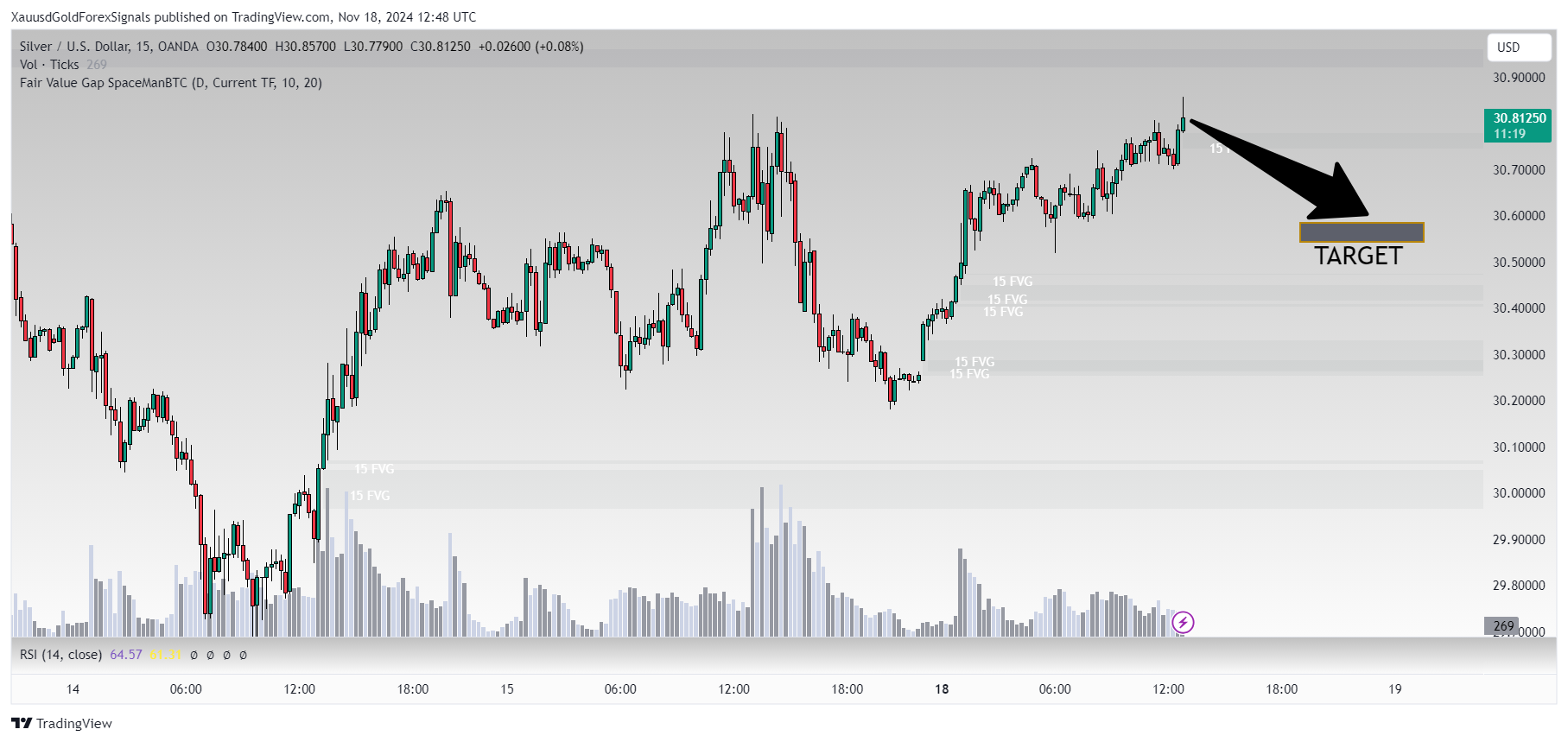 OANDA:XAGUSD Chart Image by XauusdGoldForexSignals
