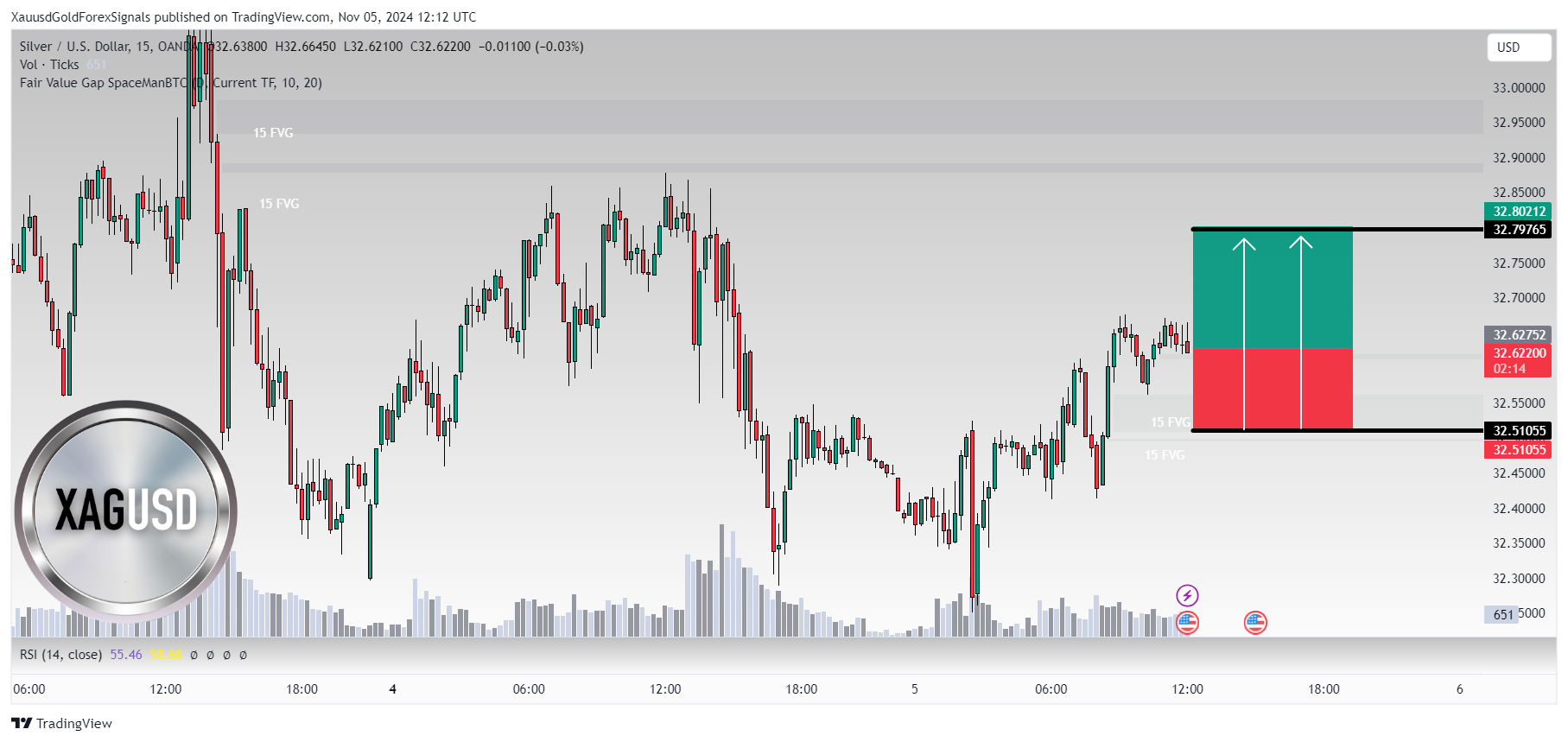 OANDA:XAGUSD Chart Image by XauusdGoldForexSignals
