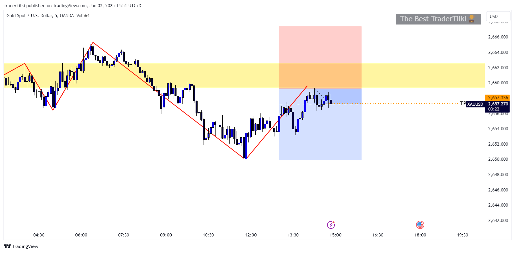 OANDA:XAUUSD Chart Image by TraderTilki