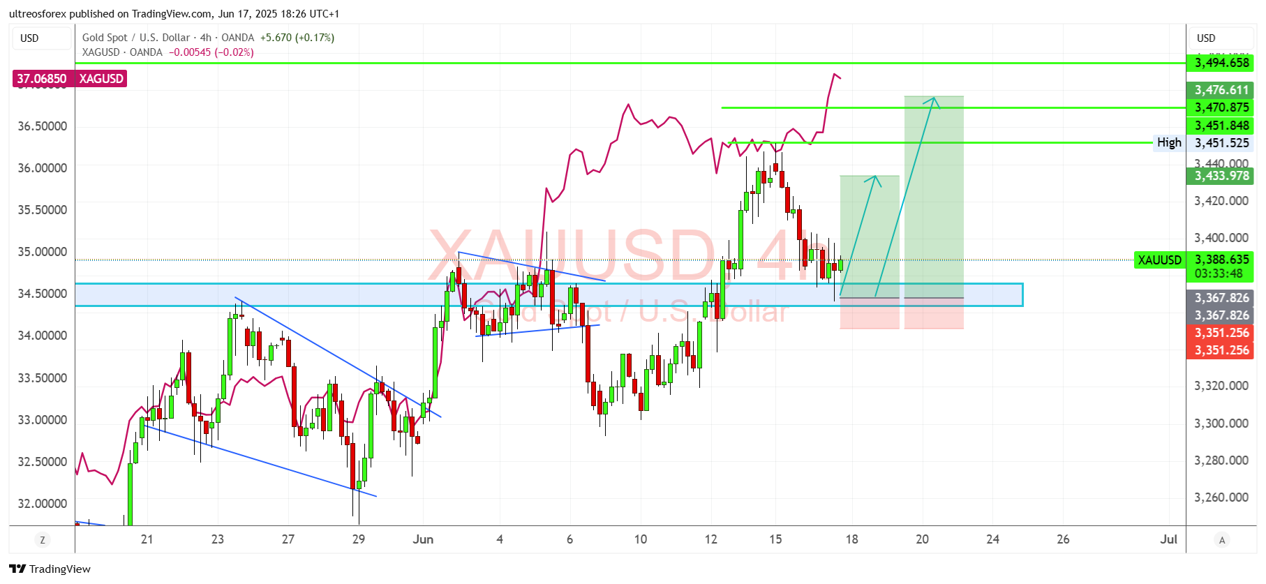OANDA:XAUUSD Chart Image by ultreosforex