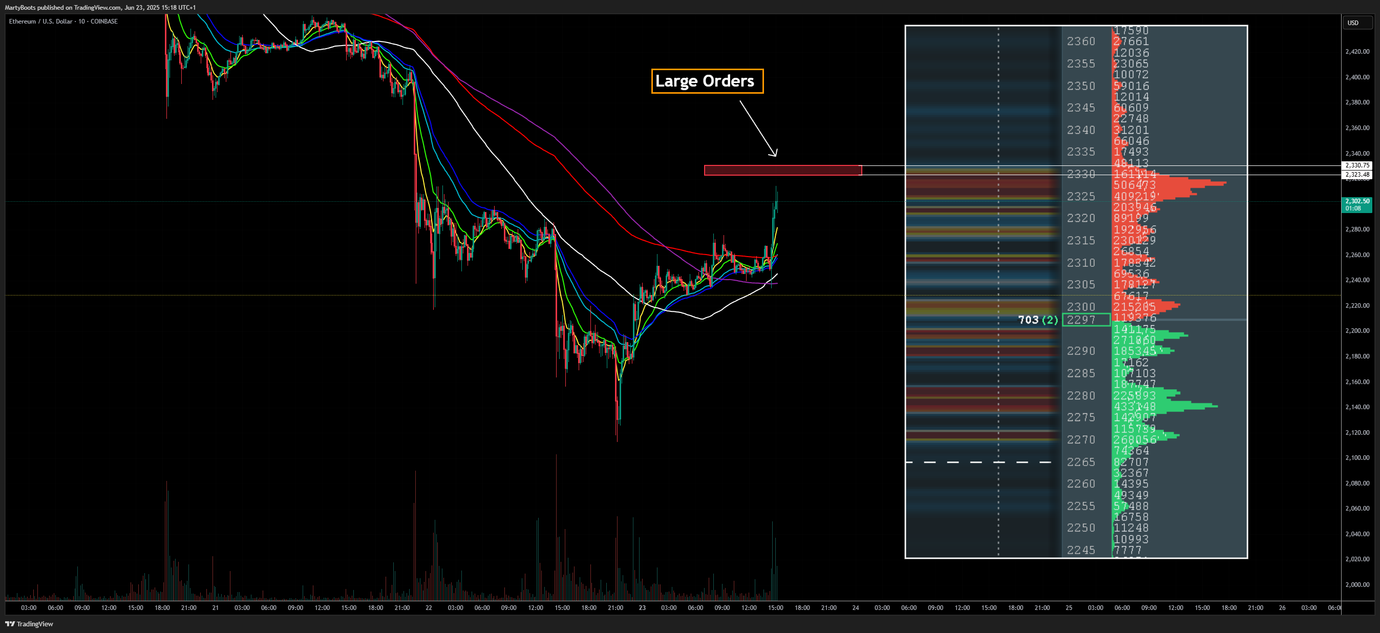 COINBASE:ETHUSD Chart Image by MartyBoots