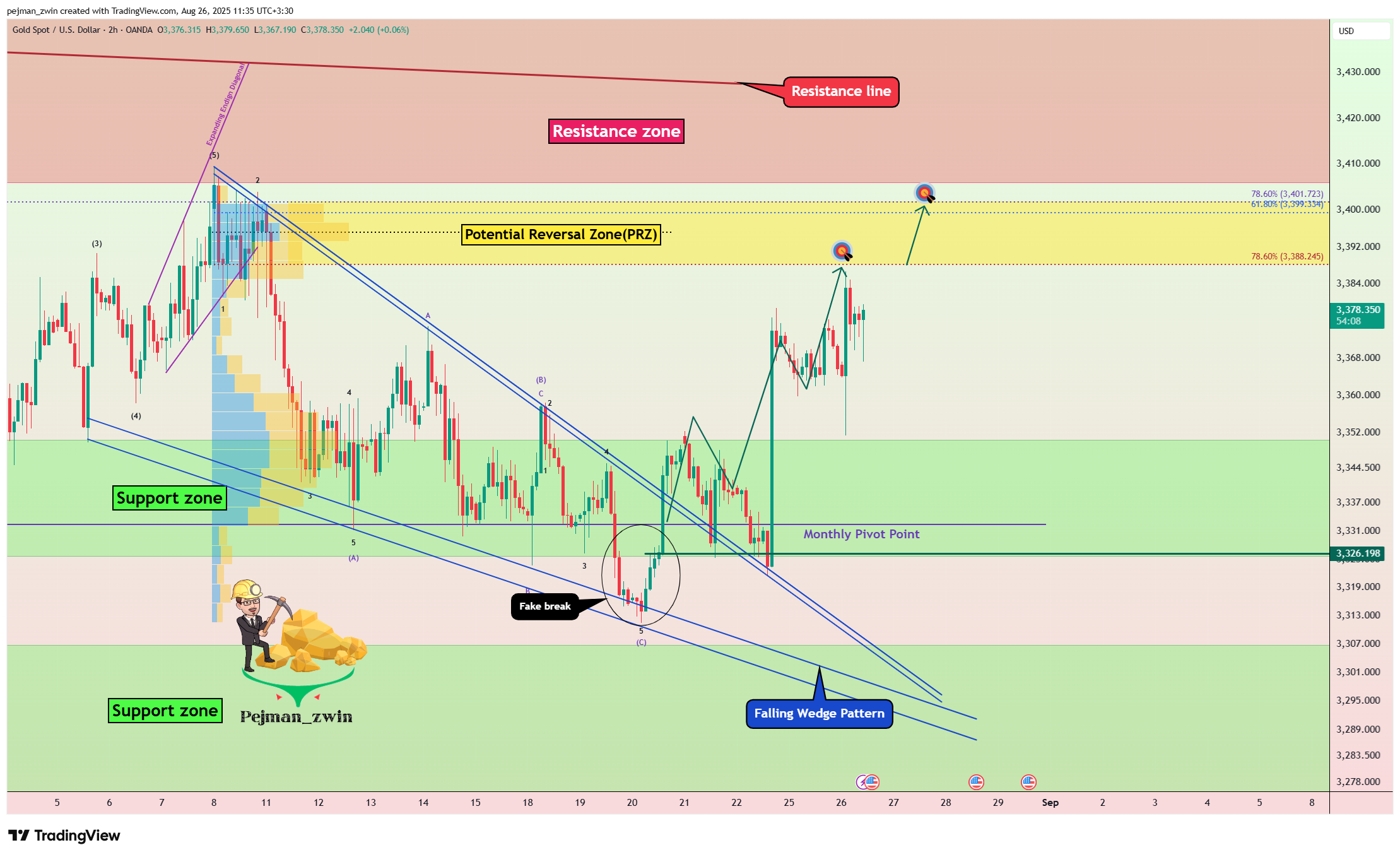 OANDA:XAUUSD Chart Image by pejman_zwin