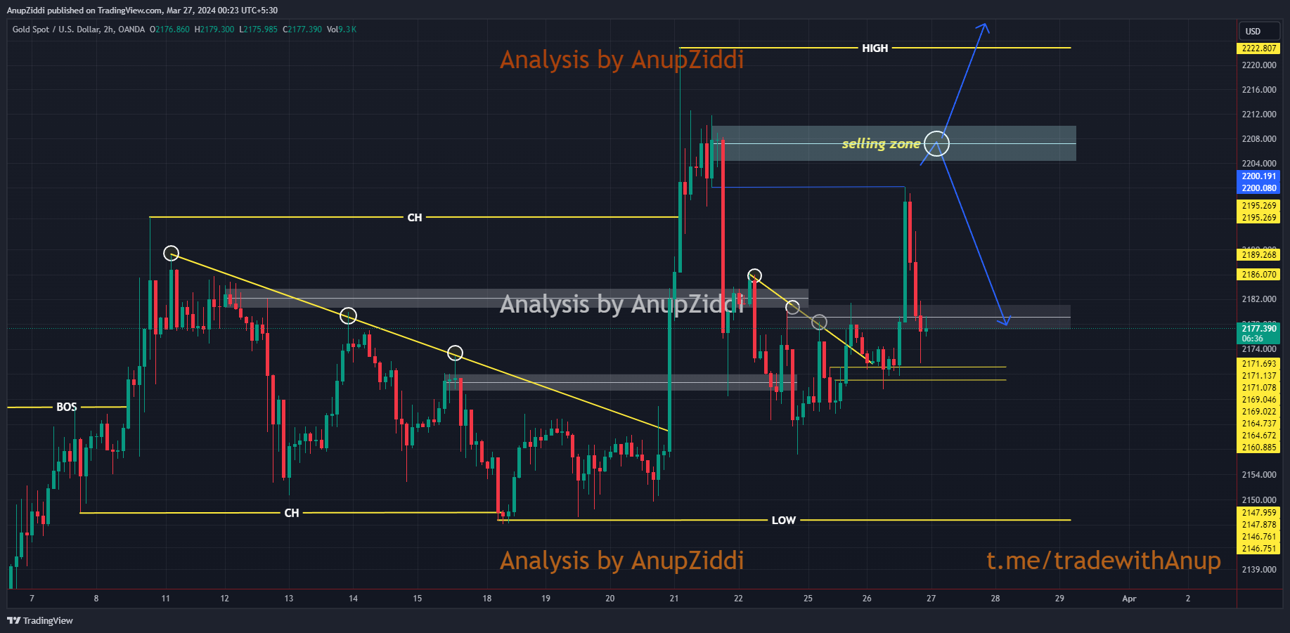 OANDA:XAUUSD Chart Image by AnupZiddi