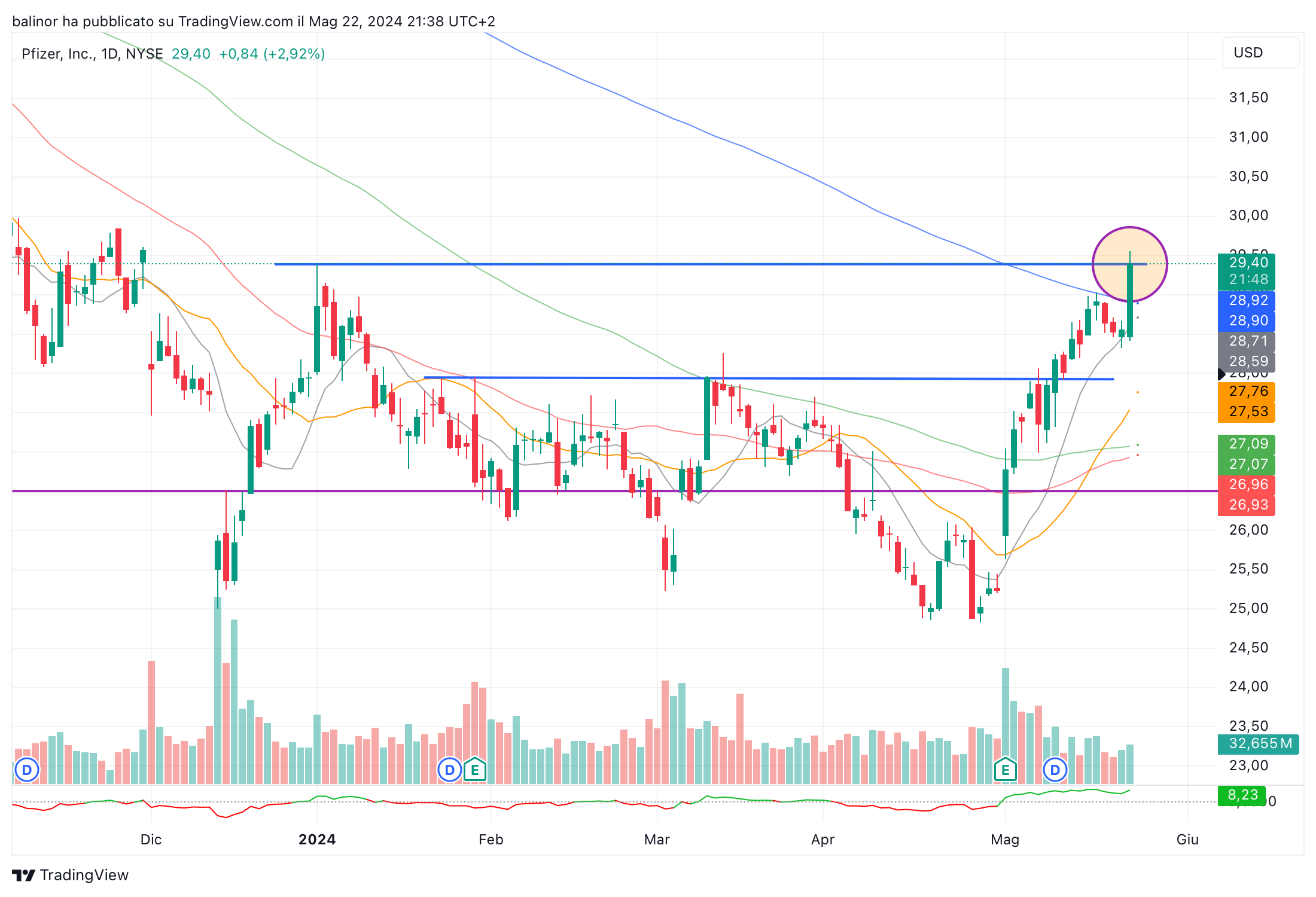 BATS:PFE Chart Image by balinor