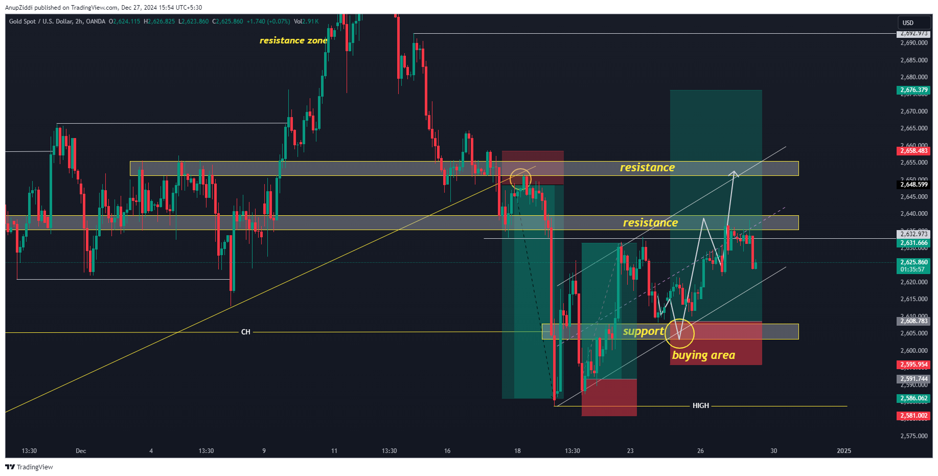 OANDA:XAUUSD Chart Image by AnupZiddi