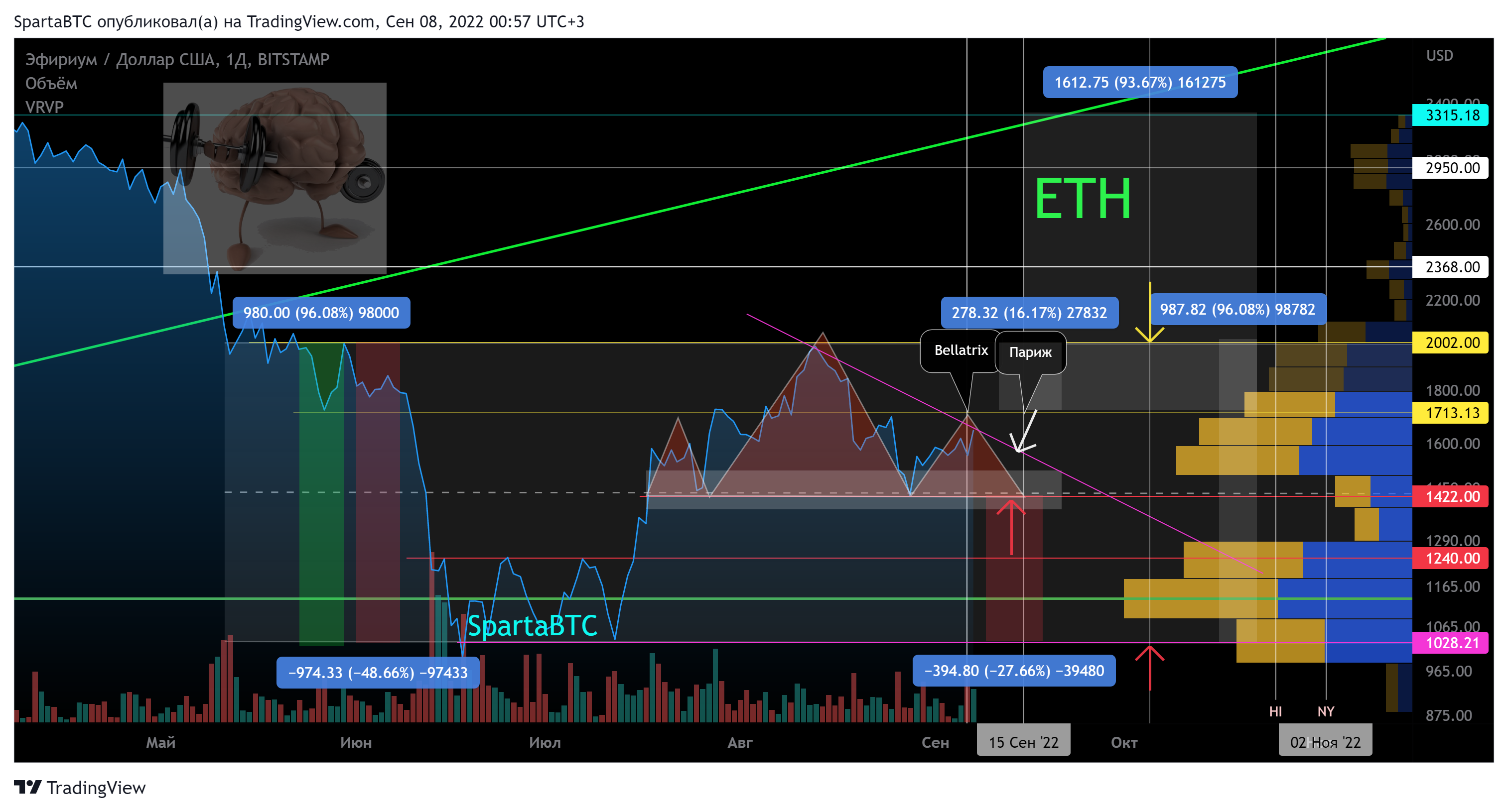 BITSTAMP:ETHUSD Chart Image by SpartaBTC