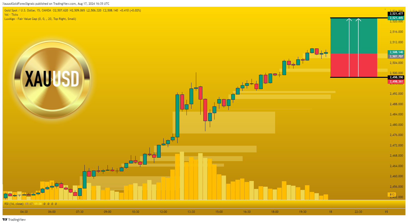 OANDA:XAUUSD Chart Image by XauusdGoldForexSignals