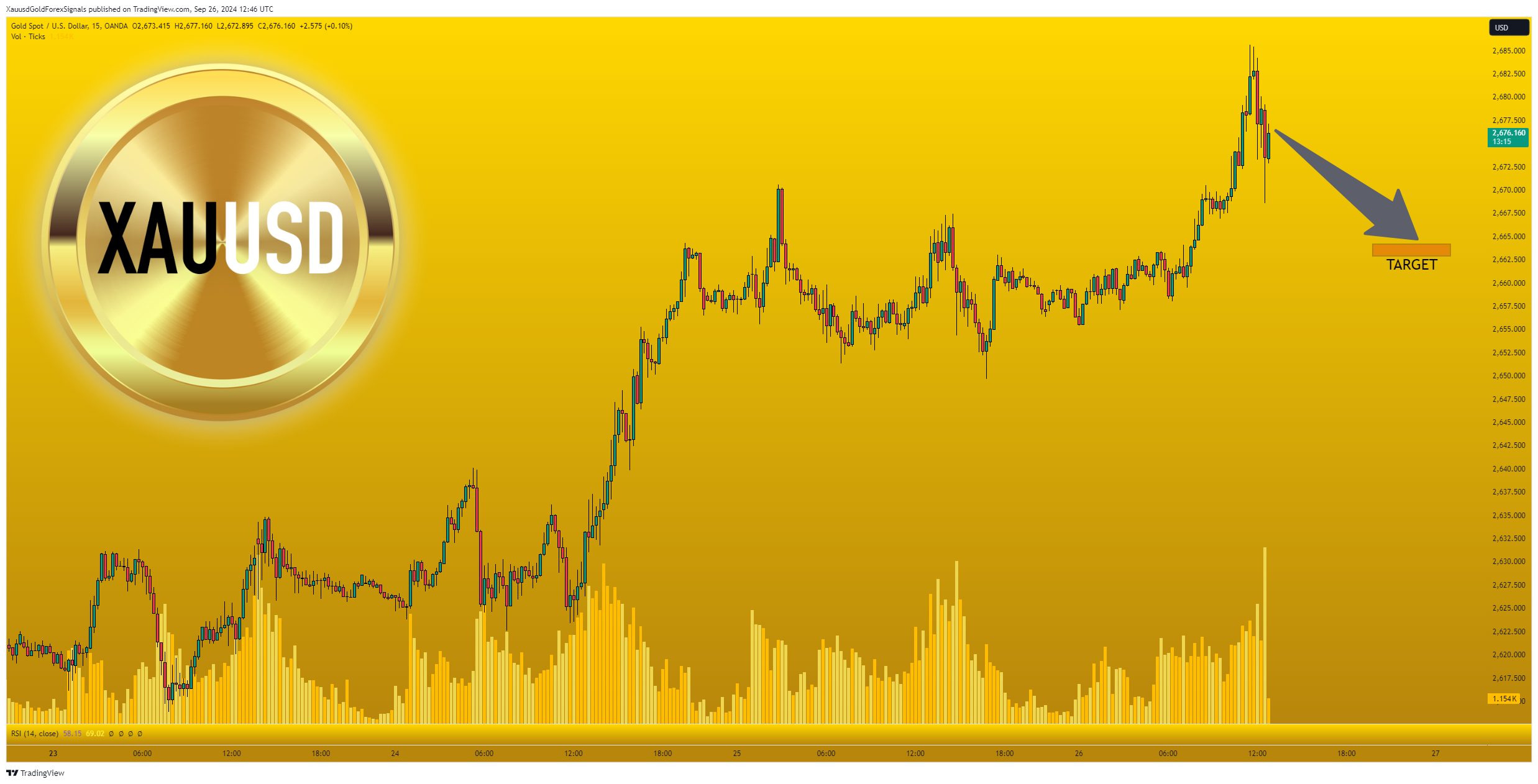 OANDA:XAUUSD Chart Image by XauusdGoldForexSignals