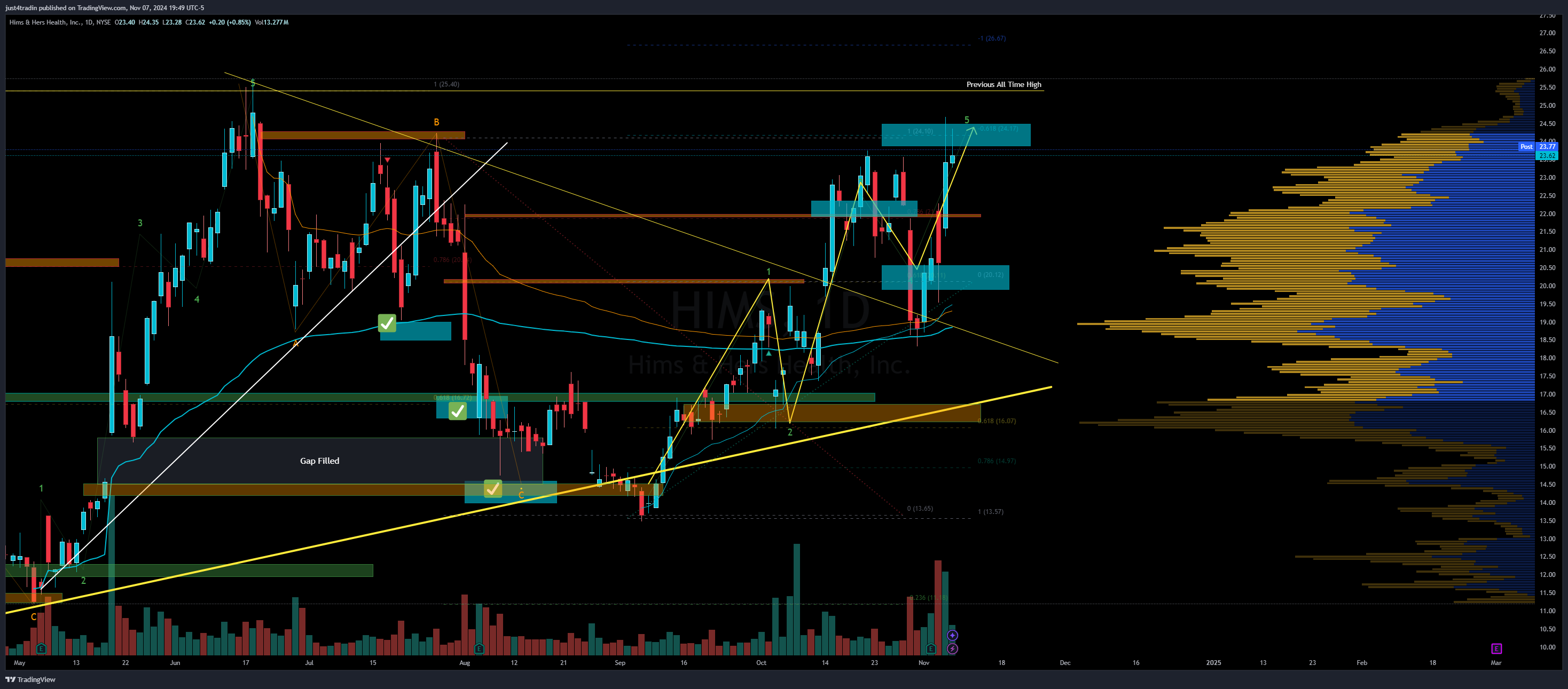 NYSE:HIMS Chart Image by just4tradin