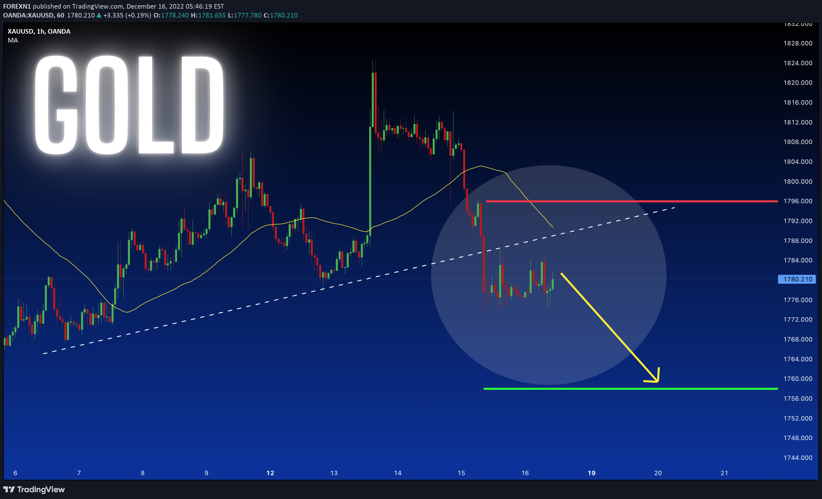 OANDA:XAUUSD Idea Chart Image by FOREXN1