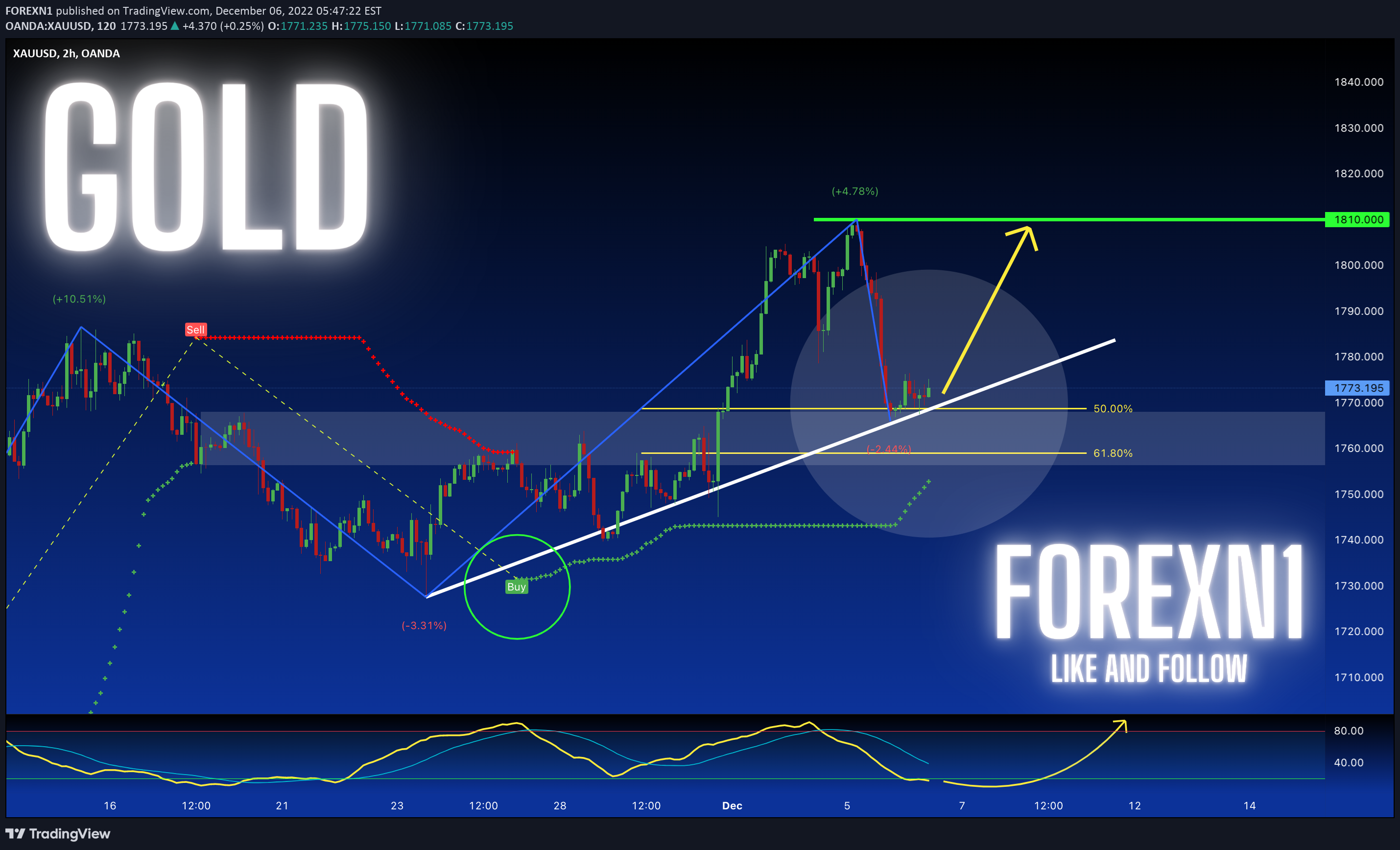 OANDA:XAUUSD Idea Chart Image by FOREXN1
